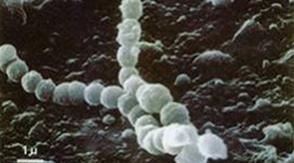 むし歯菌(ミュータンス連鎖球菌)