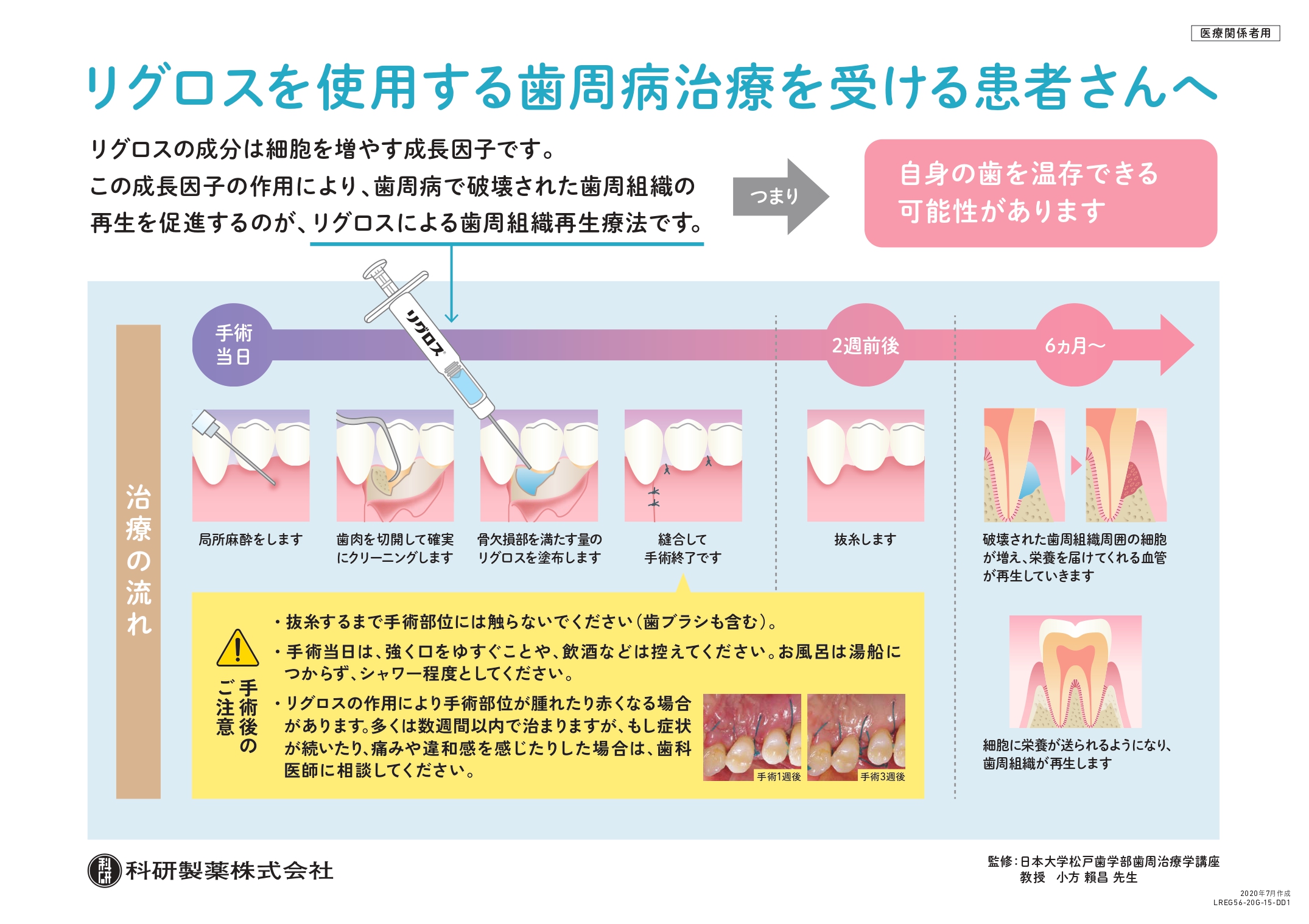  歯周外科手術